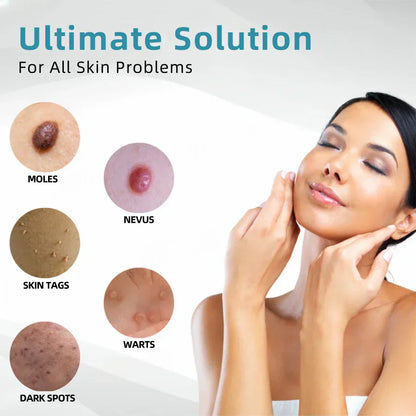 ☂TrackMuller® VelvetSkin+Series ⚔️All-in-One Laser Eraser Pen🖊️ (🔬Powered by CO₂ laser technology – effectively removes moles, warts, skin tags, pigmentation spots, and other skin imperfections)