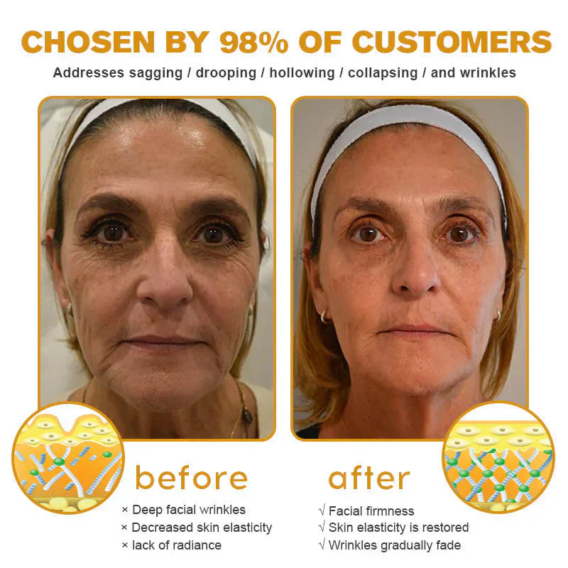👨‍⚕️ Hergestellt und versendet in den DE ✅ Botox-Bienengift-Faltenentfernungscreme – LETZTER TAG 80 % RABATT