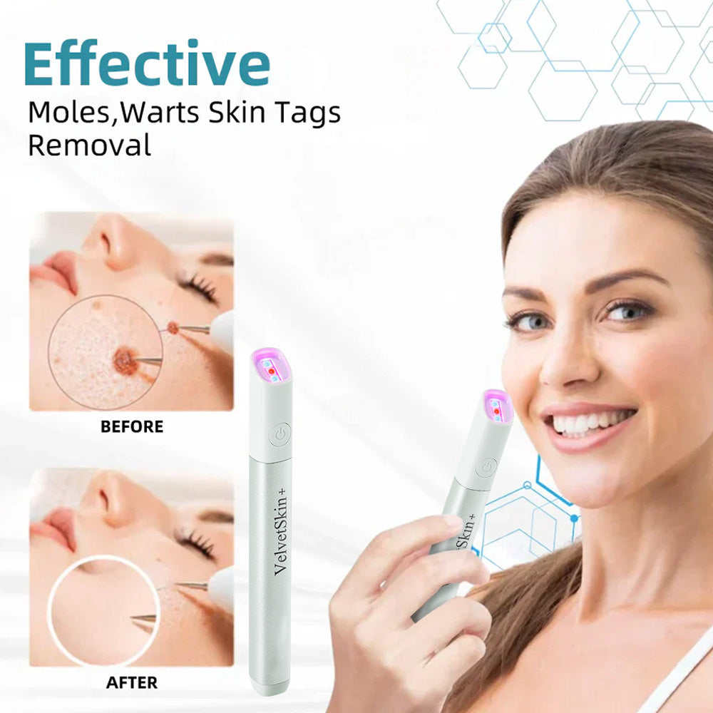 ☂TrackMuller® VelvetSkin+Series ⚔️All-in-One Laser Eraser Pen🖊️ (🔬Powered by CO₂ laser technology – effectively removes moles, warts, skin tags, pigmentation spots, and other skin imperfections)