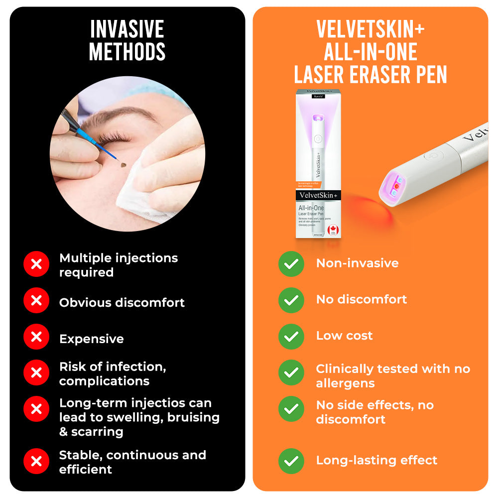 ☂TrackMuller® VelvetSkin+Series ⚔️All-in-One Laser Eraser Pen🖊️ (🔬Powered by CO₂ laser technology – effectively removes moles, warts, skin tags, pigmentation spots, and other skin imperfections)